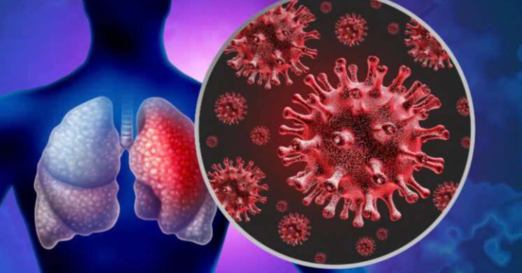 ​Thông tin về các trường hợp mắc bệnh do vi rút gây viêm phổi trên người